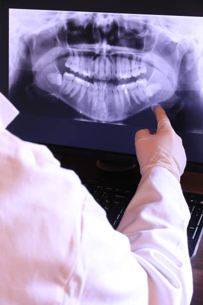 Best Emergency Treatment for Dental Infections or Abscesses in Vero Beach, FL